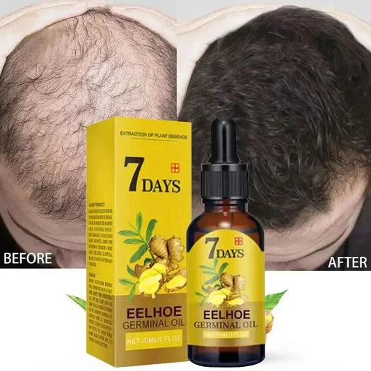 Ginger Hair Growth Serum Anti Hair loss Baldness Fast Regrowth