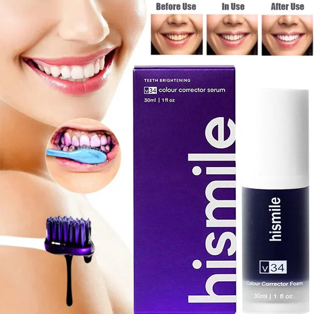 hismile Teeth Whitening