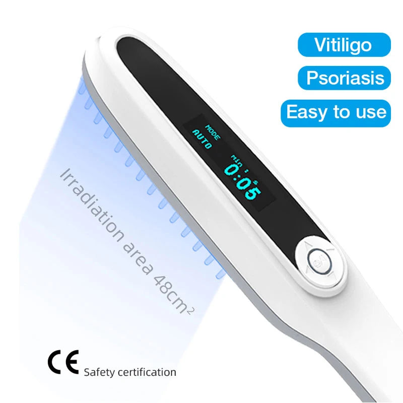 UVB Ultraviolet Phototherapy Instrument Vitiligo Treatment Ultraviolet Lamp Laser Psoriasis Lamp Phototherapy Vitiligo