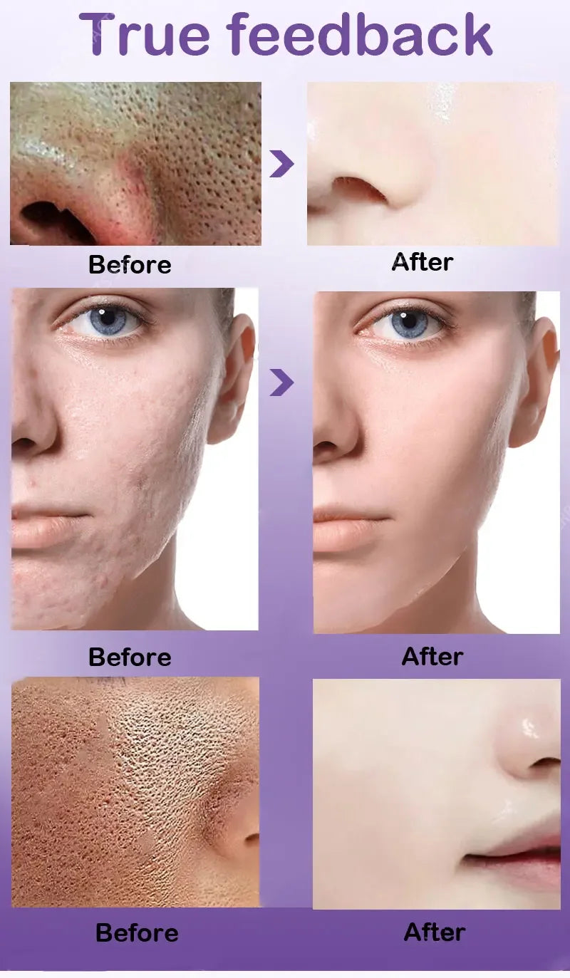 Face Pore Shrinking Serum Shrink Pores Lactobionic Acid Firming Moisturizing Essence