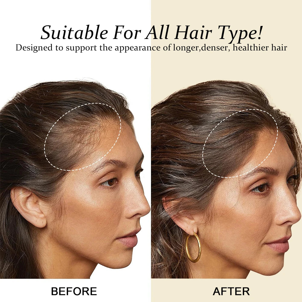 Hair Growth Products Men Women Ginger Fast Regrowth Oil Anti Hair Loss Scalp Treatment Serum Thicken Grow Hair Care Oil PURC