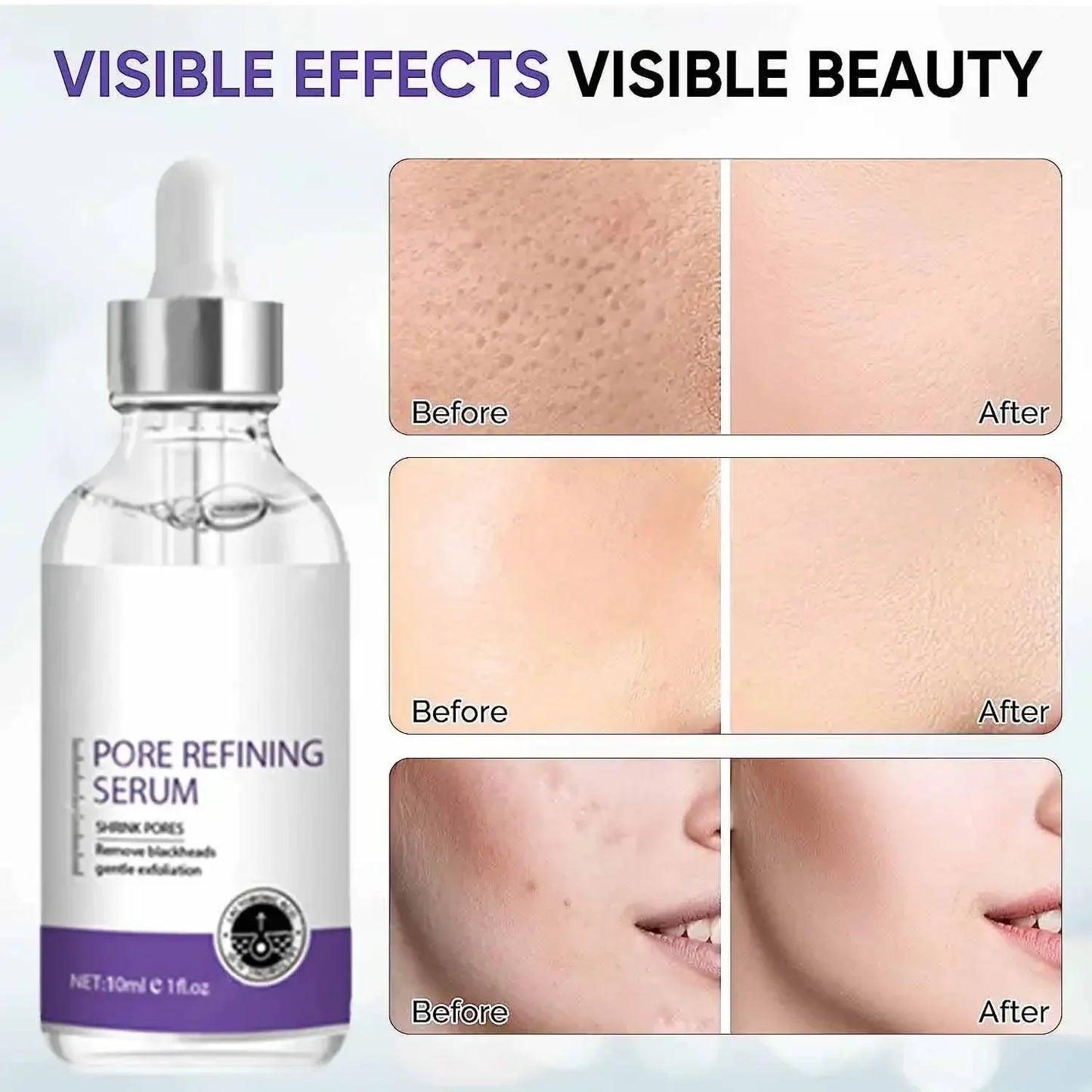 Skin care Essence oil facial moisturizing serum