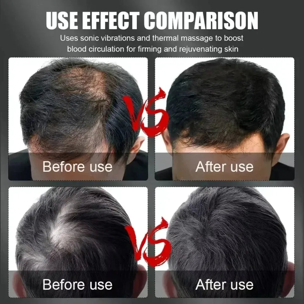 Jecaliz Red Light Infrared 660&850nm Hair Therapy Hair Growth Cap for Regrowth Anti Hair Loss Relax Scalp Care Hat Type-C Cable