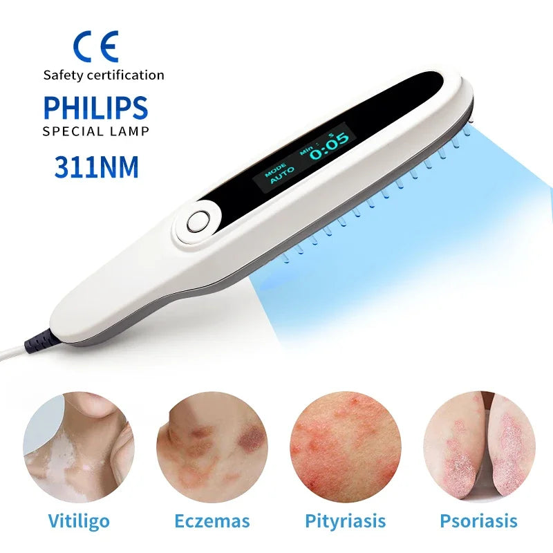 UVB Ultraviolet Phototherapy Instrument Vitiligo Treatment UV 311nm Is Recommended By Doctors To Treat Psoriasis Vitiligo