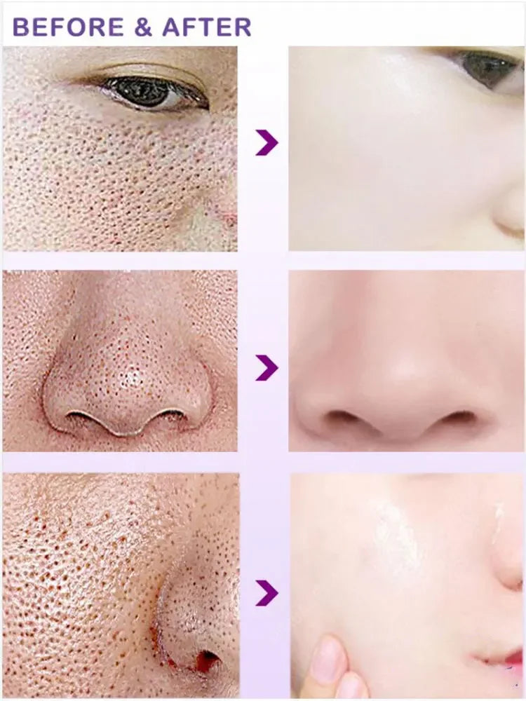 Face Pore Shrinking Serum Shrink Pores Lactobionic Acid Firming Moisturizing Essence