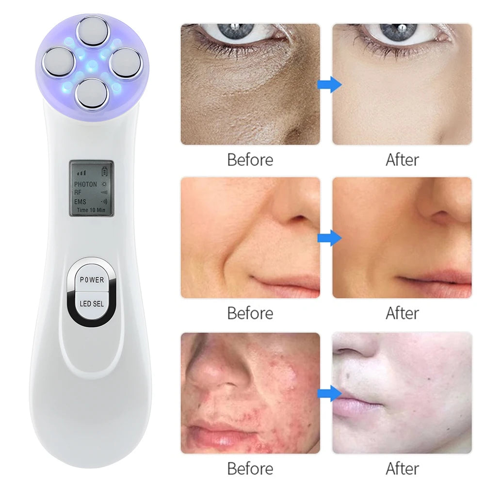 RF Radio Frequency Beauty Instrument 5 Colors LED Photon Skin Care Face Lifting Wrinkles Removal Facial Massager Dropshipping