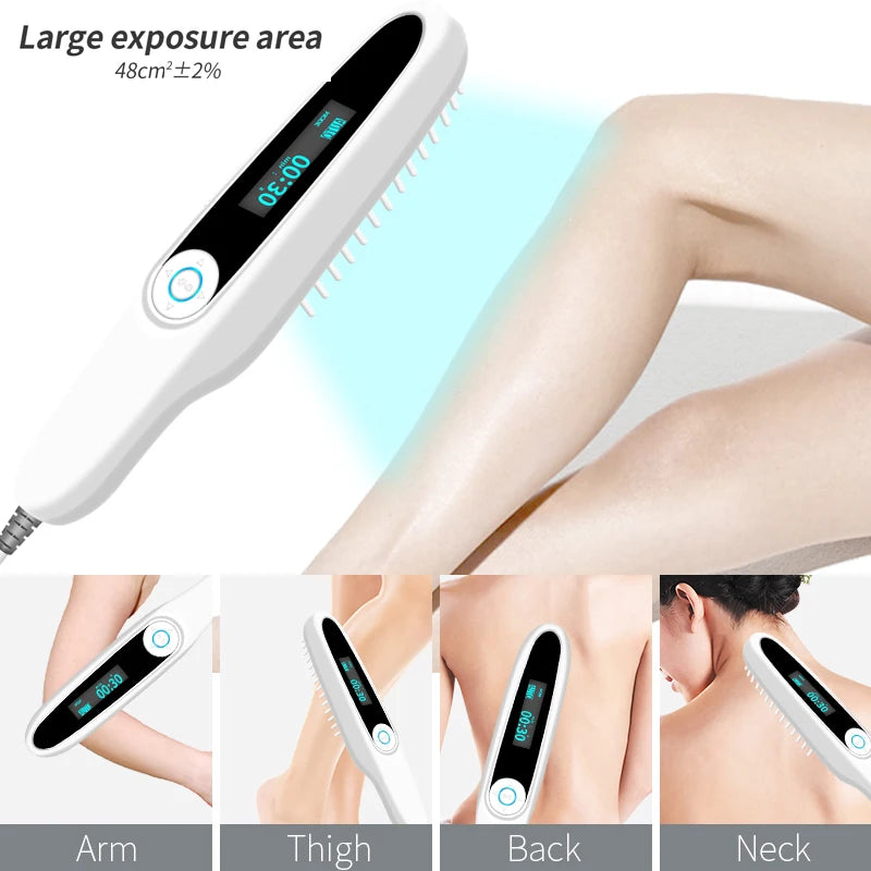 UVB Ultraviolet Phototherapy Instrument Vitiligo Treatment Ultraviolet Lamp Laser Psoriasis Lamp Phototherapy Vitiligo